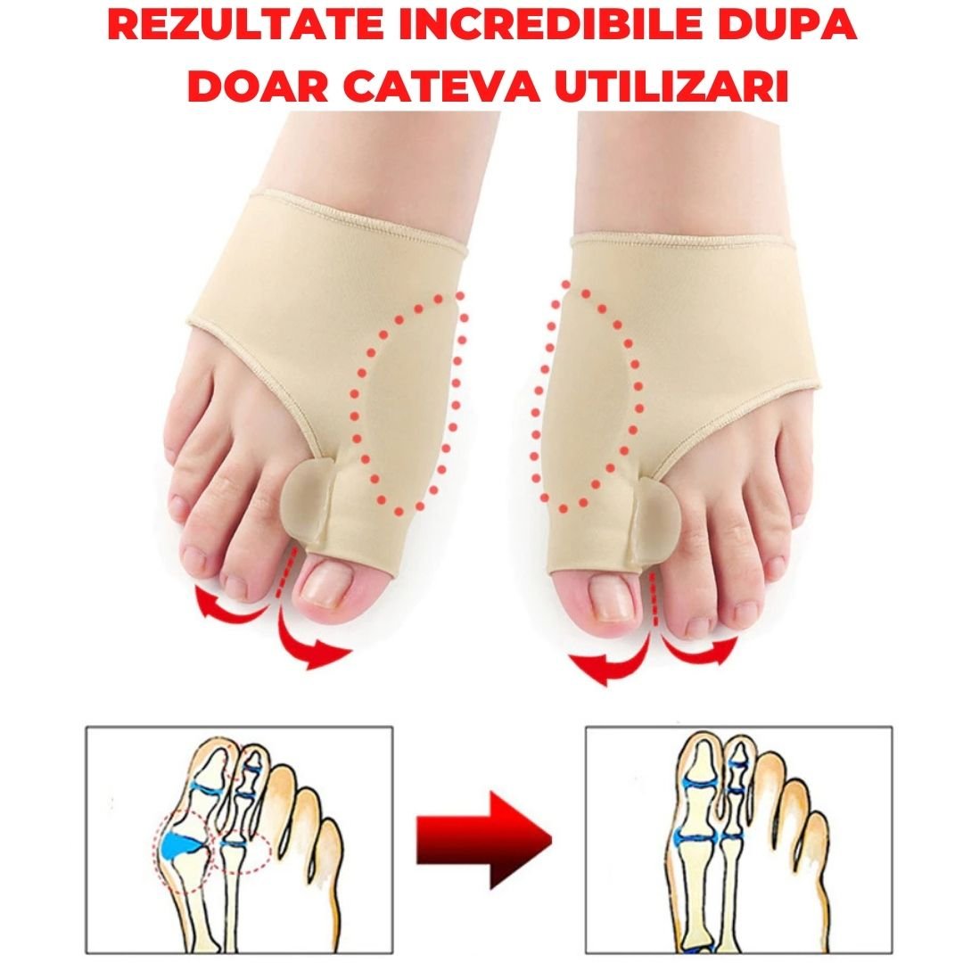 SET 2 CORECTOARE MAGICE PENTRU MONTURI